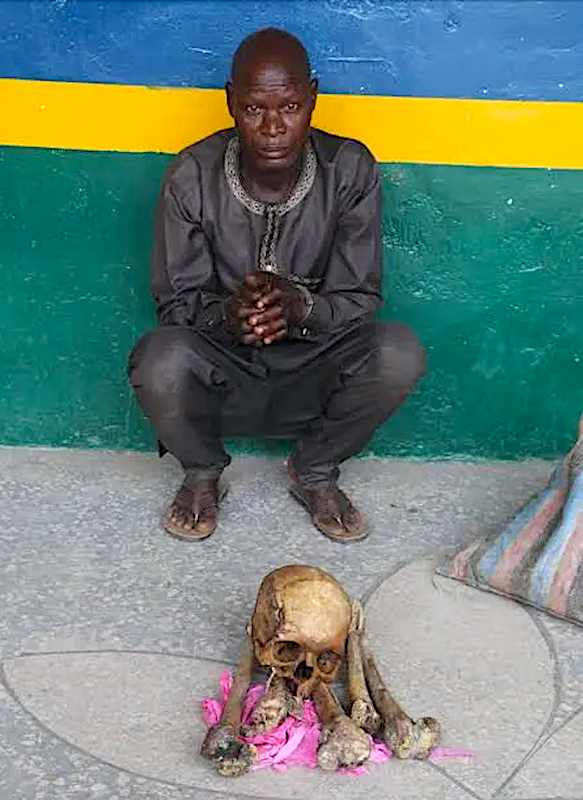 Police arrest man with human skull, bones