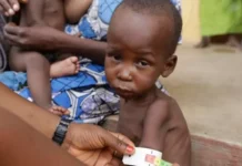 FCTA, UNICEF, US department partner to tackle malnutrition in Abuja